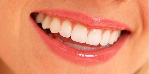Звички, які найбільше можуть зіпсувати зуби. Стоматологи розповіли, що найчастіше стає причиною руйнування зубів.