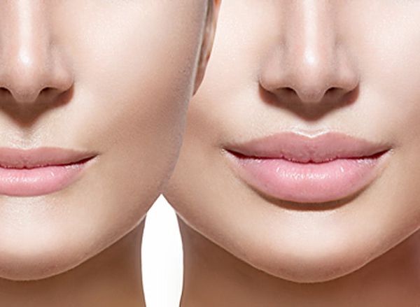 4 способи збільшити губи в домашніх умовах. Заради звабливих пухких губ деякі жінки вирішуються на болючі ін'єкції та пластичні операції.