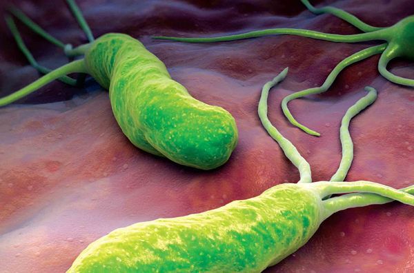 Ось як позбутися від Helicobacter pylori, що викликають печію, виразку та здуття живота. Здоров'я – перш за все.