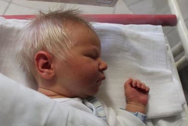 В Угорщині народився малюк з сивим волоссям! Ось як феномен пояснили лікарі. Батьки досі в шоці!