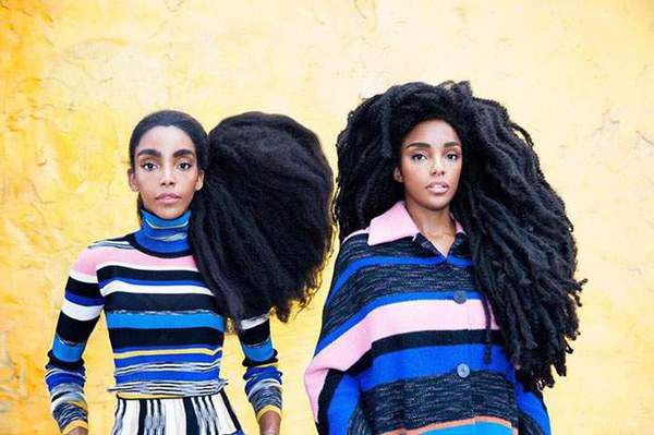 Сестри-близнюки, які стали відомими завдяки своєму незвичайному волоссю. Ці ефектні дівчата більшу частину свого свідомого життя комплексували із-за своєю неординарної зовнішності.