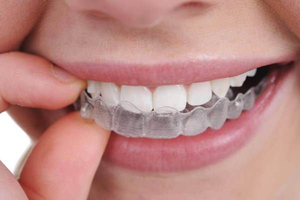 Зуби майбутнього. Стоматолог розповідає про сучасні технології. Сучасні технології стоматології - Люмініри, Елайнери, Zoom, Cerec.