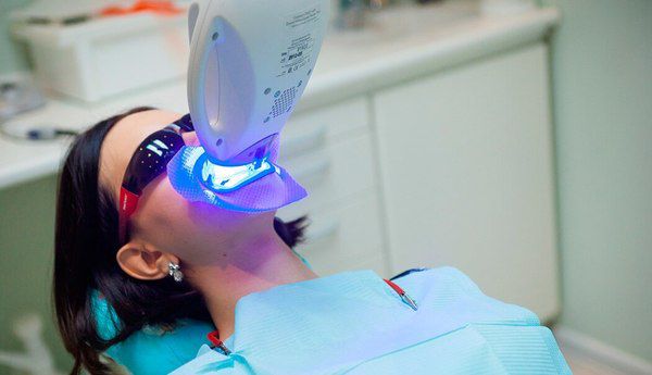Зуби майбутнього. Стоматолог розповідає про сучасні технології. Сучасні технології стоматології - Люмініри, Елайнери, Zoom, Cerec.