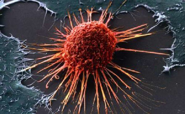 Вчені: У поширенні раку винне людство. Діяльність людини стала причиною масового поширення онкологічних захворювань.