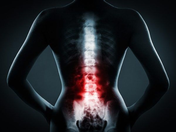 Желатин проти болів у спині і суглобах. Простий желатин допоможе впоратись з різними проблемами спини і кінцівок.