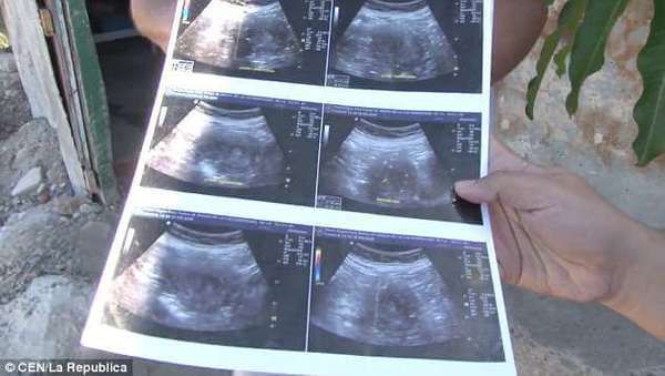 70-річна мексиканка вагітна восьмою дитиною. Диво чи обман?