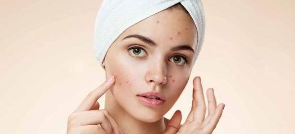 Чому лущиться шкіра на обличчі і як це виправити. Швидке усунення проблем шкіри.