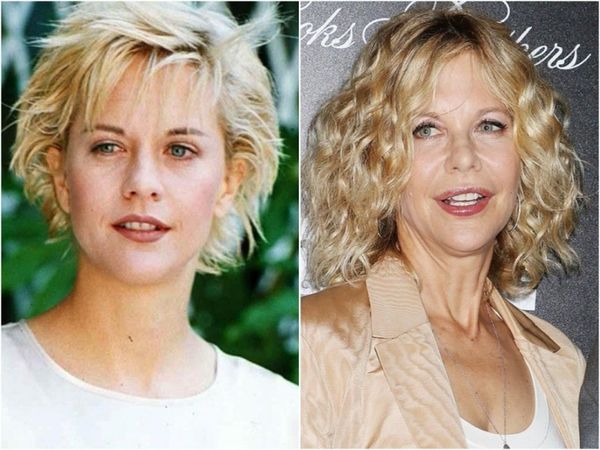 Як змінилися обличчя зірок до і після пластичних операцій. Деяких складно впізнати на ранніх фотографіях.
