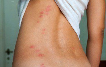 Отзывы о защитный спрей для кожи от укусов комаров и мошек - natura house zinzala spray