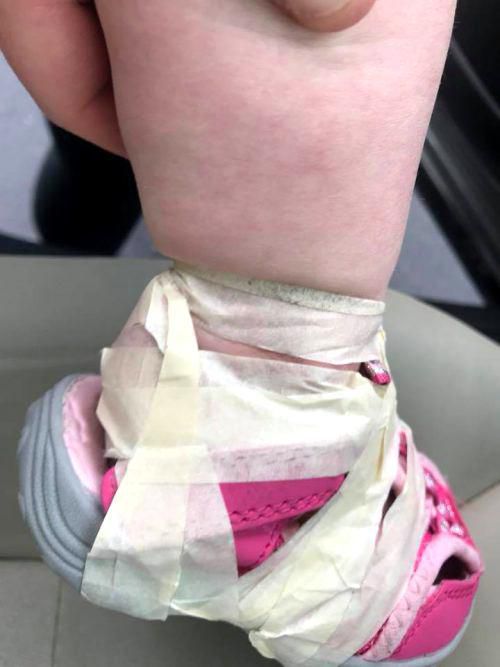 Дівчина забрала свою дочку з дитсадка  і помітила на її ніжках дивні сліди. Жахливі методи виховання..