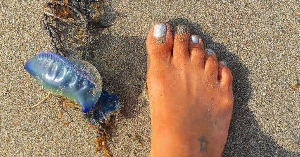 Якщо побачите цю штуку на пляжі - не чіпайте і не підходьте близько! Ось чому. Це отруйна медуза.