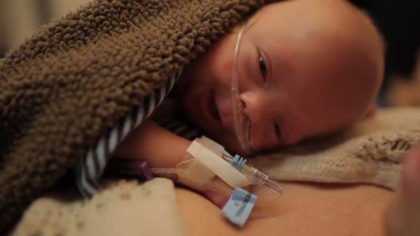 Цей хлопчик народився на 3,5 місяці раніше терміну і важив 680 грамів. Минуло 4 роки. 107 довгих ночей без мами у палаті інтенсивної терапії і величезна жага до життя.