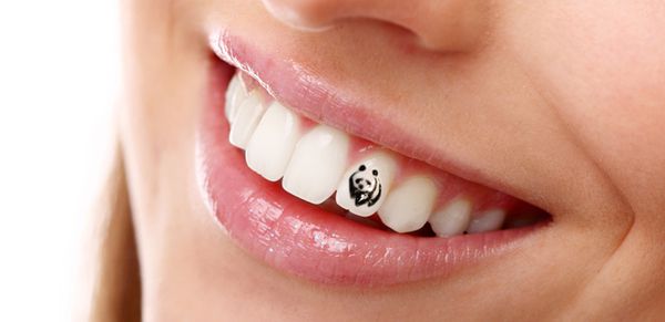 Скайси: данина моді чи необхідність?. До дантиста сьогодні звертаються не тільки для того, щоб підлікувати зуб, видалити зубний наліт і камінь, встановити коронку.