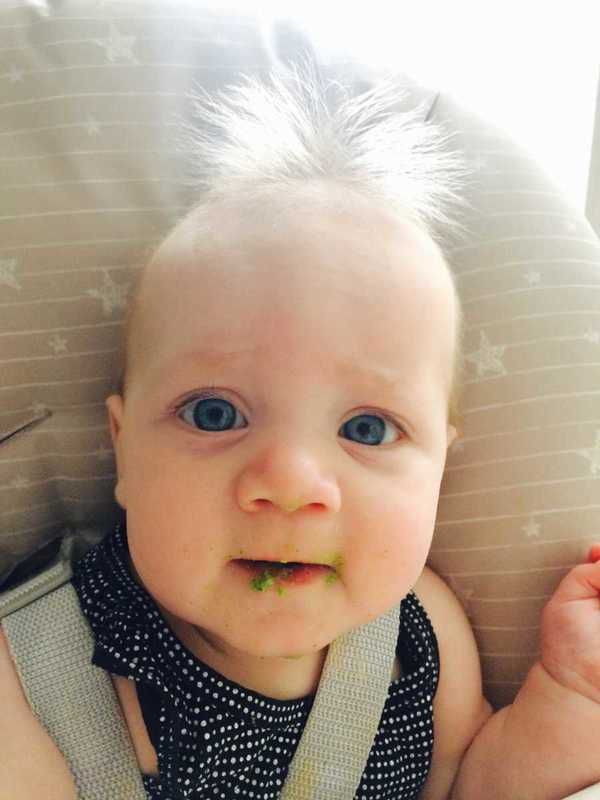 Це чудове дитя має синдром нерозчісуючогося волосся. І це рідкісна генетична причуда.
