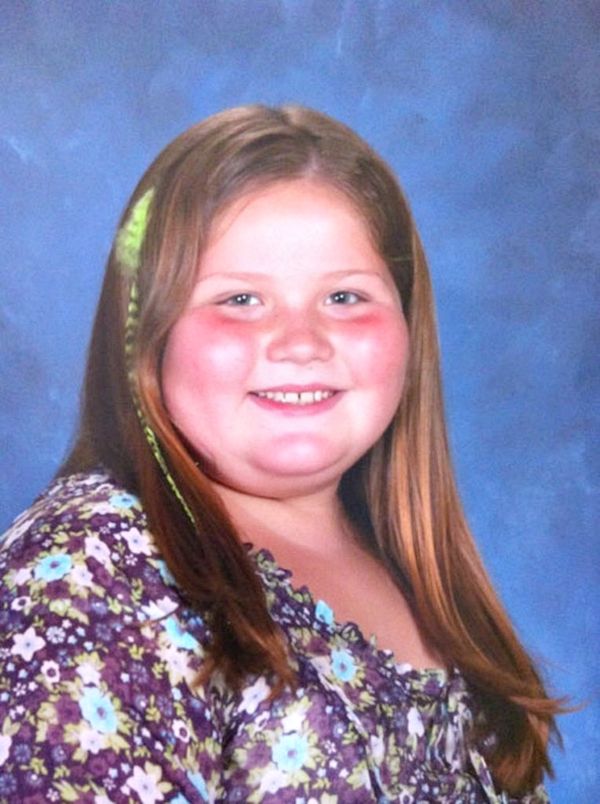 Всі діти в класі труїли цю 9-річну дівчинку через її величезну вагу. Але погляньте на неї тепер!. В свої 9 років дівчинка важила 84 кілограми.