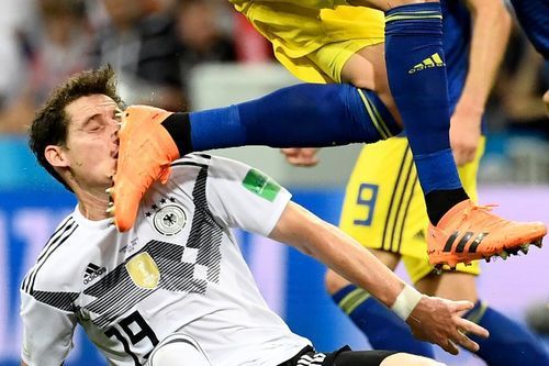 Півзахиснику збірної Німеччини зламали ніс. Себастьян Руді змушений був залишити поле в матчі зі Швецією.
