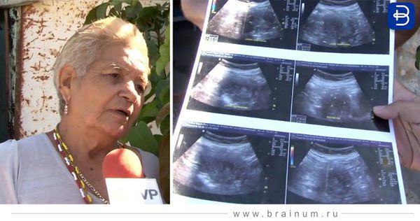 Вагітна у 70! Найстаріша мати в історії. 70-річна жінка з Мазатлана, місто, на узбережжі Мексики, стверджує, що вона на шостому місяці вагітності.