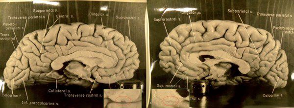 У німецькому музеї виставили на показ мозок Ейнштейна. Виставка в Музеї природознавства в Мюнстері працюватиме до 27 жовтня 2019 року.