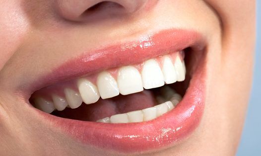 5 несподіваних продуктів, які вбивають наші зуби. Виявляється, шкідливими для зубів можуть виявитися не лише карамель і тверді горіхи.