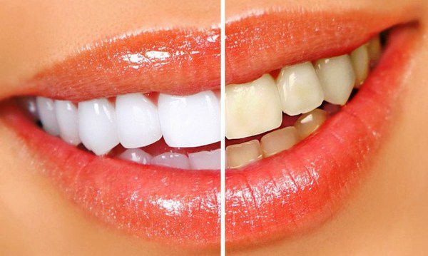 Звички, які здатні залишити вас без зубів!. Насправді факторів які сприяють руйнуванню зубів величезна кількість...