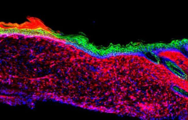 Вчені змогли виростити нову шкіру на відкритій рані. Американські дослідники довели можливість перетворення стовбурових клітин в здорові клітини шкіри не в лабораторії, а на поверхні відкритих ран.