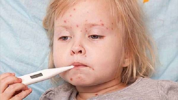 Дитячі хвороби, які важливо вміти відрізняти від застуди. На замітку батькам!