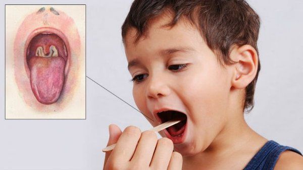 Дитячі хвороби, які важливо вміти відрізняти від застуди. На замітку батькам!