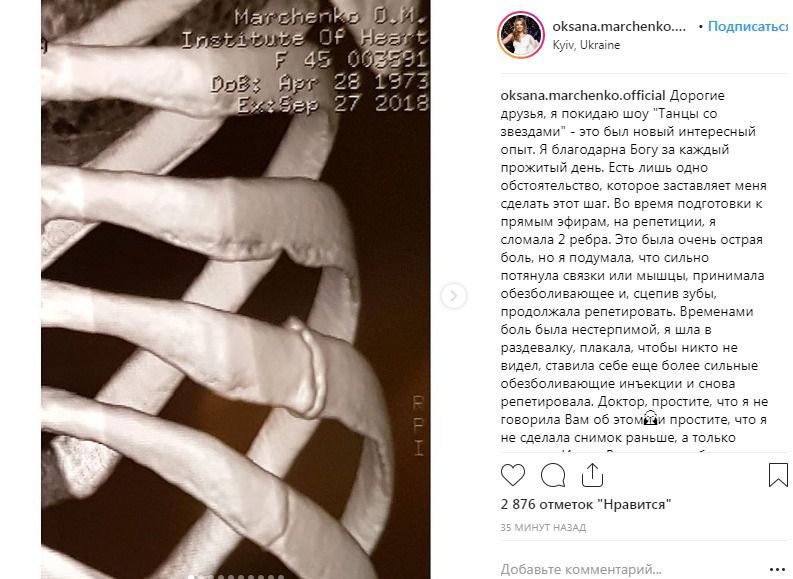 Оксана Марченко не зможе продовжувати участь у шоу "Танці з зірками" і змушена покинути проект. Оксана Марченко в шикарній формі, однак, схоже, що далося їй це дорогою ціною.