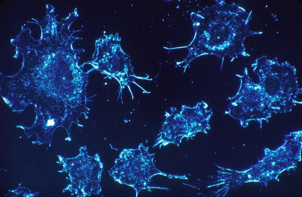 Вчені перетворили клітини шкіри на імунні клітини. Автори припускають використовувати винайдений механізм для боротьби з раком.