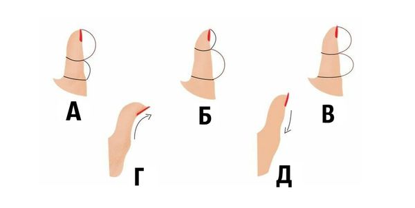 Форма великого пальця розкаже багато цікавого про риси вашого характеру. Ми пропонуємо цікаву класифікацію пальців, яка може розказати багато цікавого про вашу особистість. Подивіться на малюнок та знайдіть опис нижче.