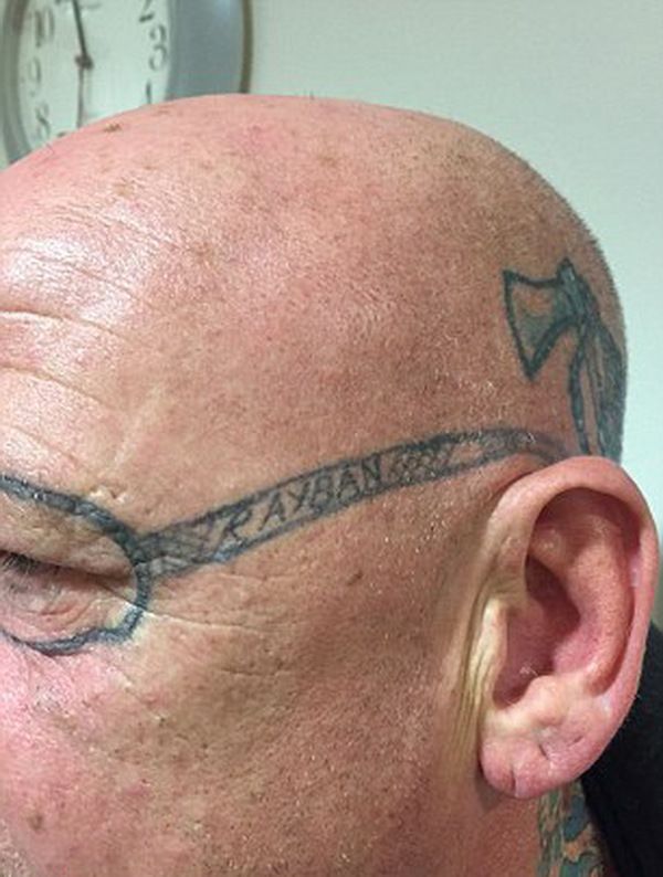 Після вечірки цей чоловік витратив 2 роки, щоб видалити «окуляри» на обличчі. Він прокинувся після холостяцької вечірки з татуюванням.