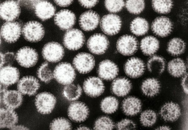 Як вчасно розпізнати ротавірус у дитини. Ротавірус або шлунковий грип може здаватися не серйозним захворюванням. Але він може бути дуже небезпечним для дітей. Важливо знати всі симптоми і бути готовим допомогти відразу ж, так як життя дитини, буквально залежить від вашої реакції.