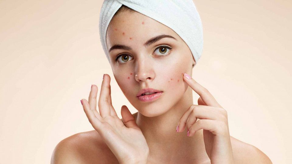 Особливо небезпечні продукти, які шкодять шкірі. Що варто виключити з раціону харчування, щоб отримати здорову шкіру обличчя?