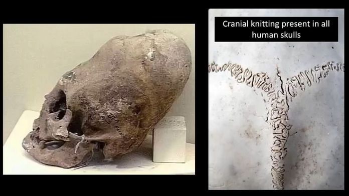 Таємничим чином тіла інопланетян знайдені при розкопках на Мальті, зникли. Однак у вчених збереглися фото знахідок.