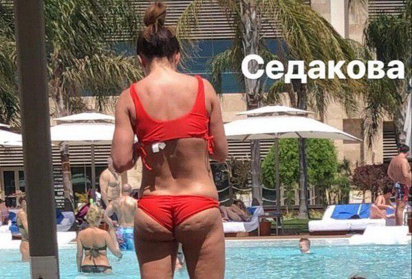 Анна Сєдокова прокоментувала своє пляжне фото з целюлітом. Фігура Сєдокової без фотошопу неприємно здивувала багатьох.