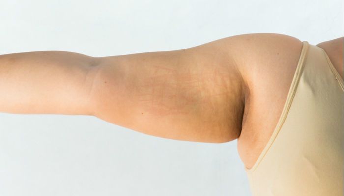 10 тривожних симптомів на шкірі, які свідчать про наявність хвороб серця. Дерматологи попереджають!
