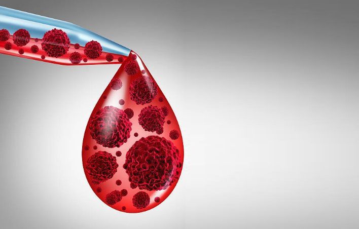 Рак крові: 6 ранніх ознак , які не можна ігнорувати. Якщо ви спостерігаєте у себе один або кілька симптомів, то обов'язково здайте аналіз крові.