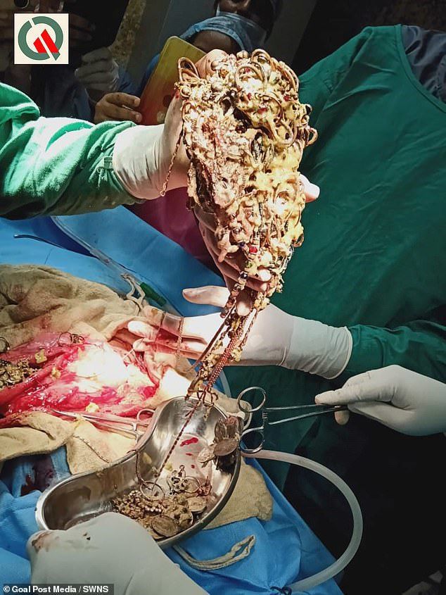 Хірурги витягли з шлунка жінки 1,5 кг ювелірних прикрас і монет