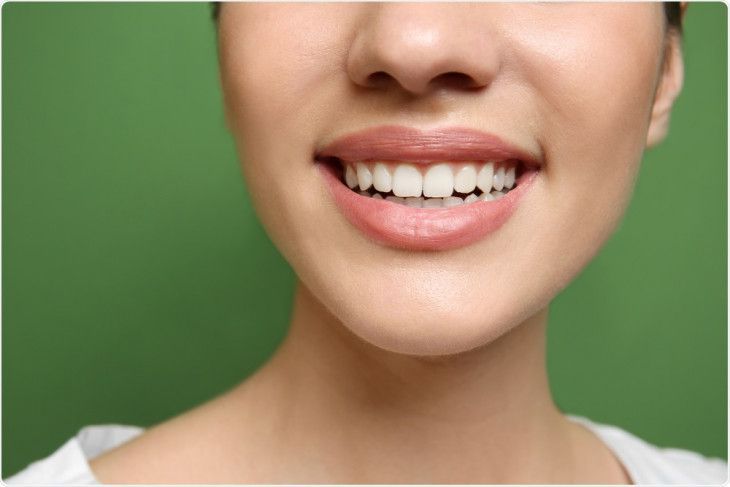 Відбілювання зубів в домашніх умовах: безпечно чи ні. Білосніжна усмішка – одне з головних достойностей зовнішності, адже вона говорить про здоров'я.