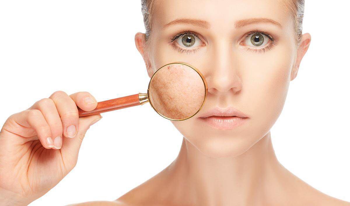 6 способів, які позбавлять ваше обличчя від плям. Плями на обличчі легко видалити.