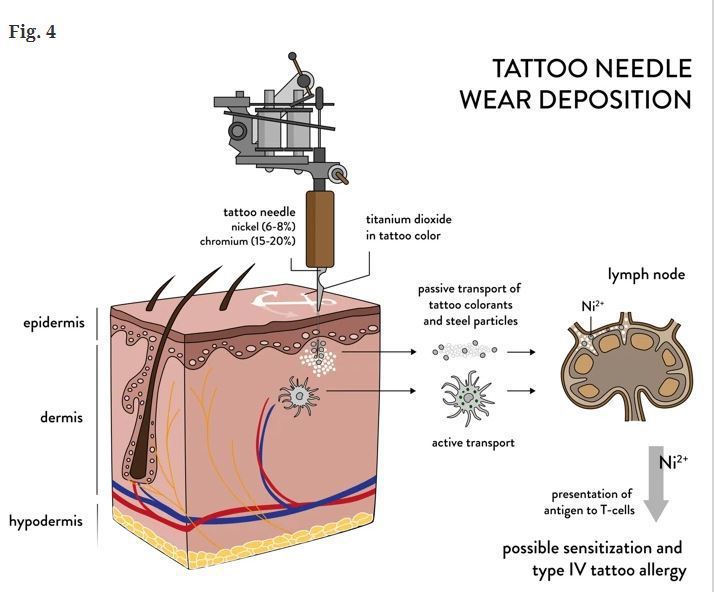 При татуюванні під шкірою залишається не тільки чорнило. Виявилося, що під час процедури в лімфовузли потрапляють небезпечні металеві наночастинки, які можуть залишитися там надовго.