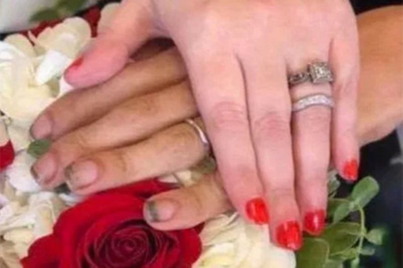 Руки нареченого на фото шокували користувачів Інтернет. Наречений забув вимити руки та почистити нігті.