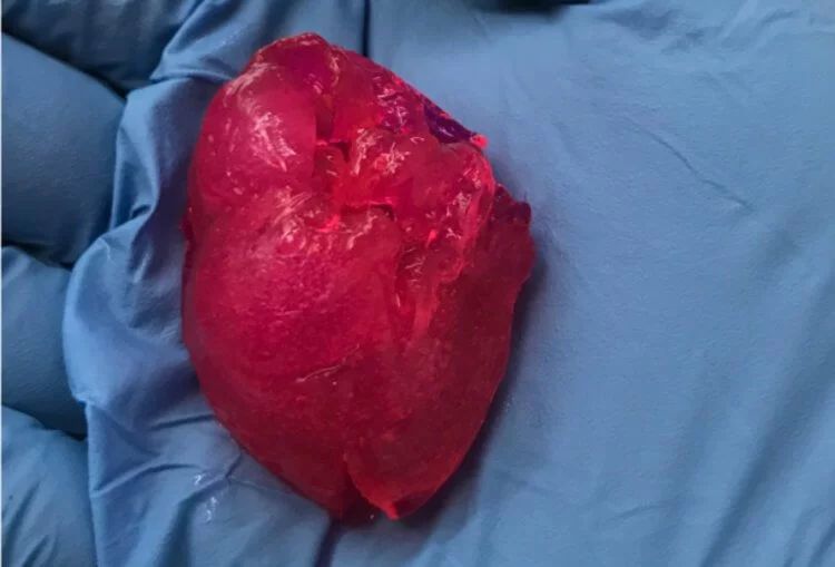 У США надрукували людське міні-серце. Сучасні біопринтери вже цілком здатні успішно здійснювати друк тканин, які навіть можна пересаджувати людині.