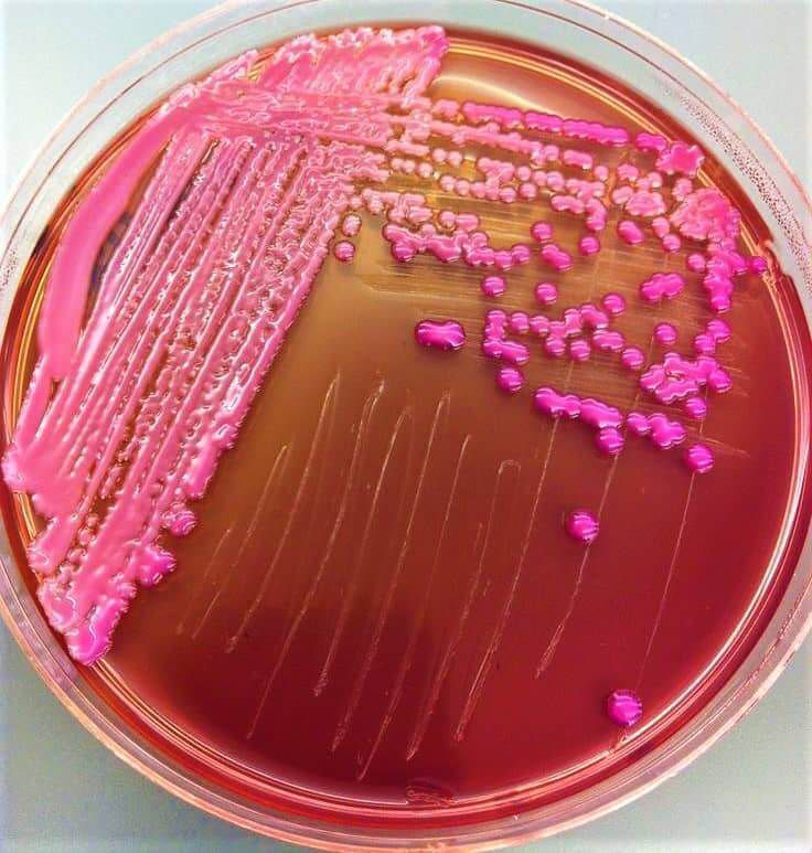 Вчені виявили бактерії, які виробляють алкоголь і призводять до цирозу печінки у непитущих. Вчені з'ясували, що хвороба, відома як «фуа-гра людини», пов'язана з забрудненням мікроорганізмами Klebsiella pneumonia.