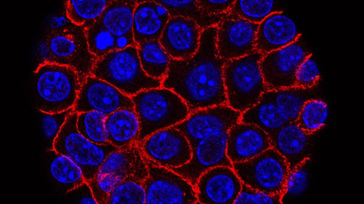 Пошкоджені хіміотерапією ракові клітини поглинають інші клітини для підвищення виживаності — вчені. Деякі пухлинні клітини під впливом доксорубіцину перетворюються на «канібалів» і не щадять своїх побратимів.