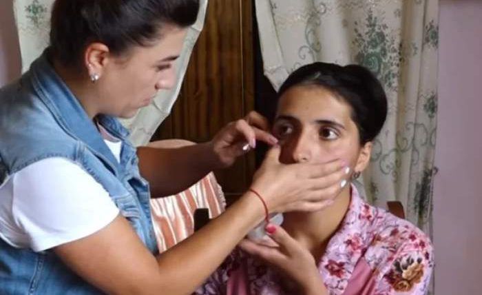 У Вірменії дівчина плаче кришталевими сльозами: лікарі не розуміють як таке можливо. У 22-річної дівчини замість сліз з очей падають кристали.