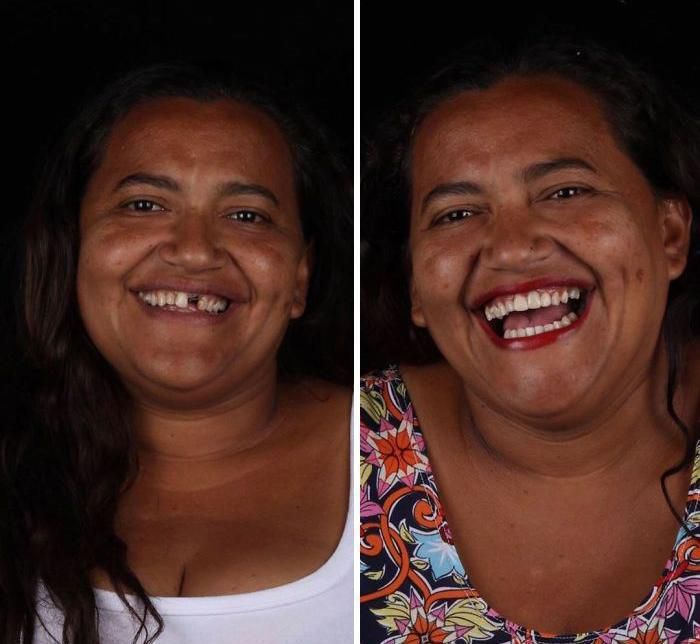 Стоматолог з Бразилії подорожує по світу, щоб безкоштовно лікувати зуби бідним. Ось 20 трансформацій.