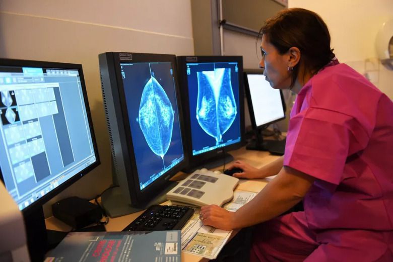Вчені виявили, що штучний інтелект діагностує рак грудей у жінок точніше за лікарів. Штучний інтелект більш точно діагностує онкологічну хворобу грудей, ніж фахівці.