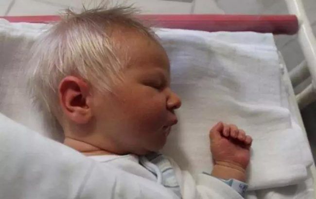 В Угорщині народився незвичайний малюк — особливістю було те, що від народження у нього сиве волосся. Малюк з сивим волоссям завоював серця багатьох.