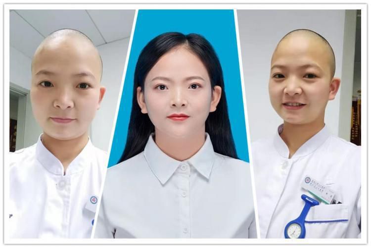 Медсестра з Уханя поголила голову і все заради того, щоб більш ефективно боротися з вірусною інфекцією. Поголивши голову, дівчина підвищила свою продуктивність на роботі.